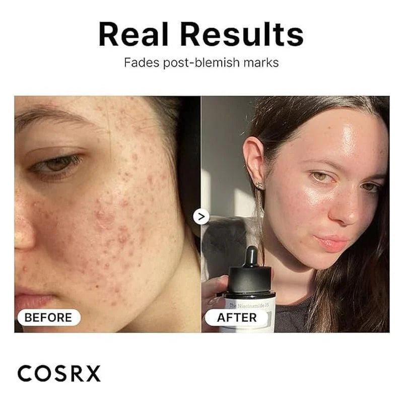 Cosrx The Niacinamide 15 Serum